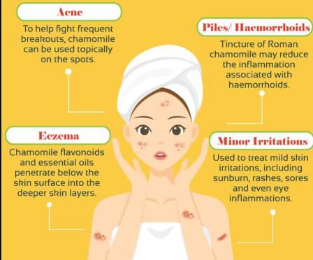 chamomile skin benefits